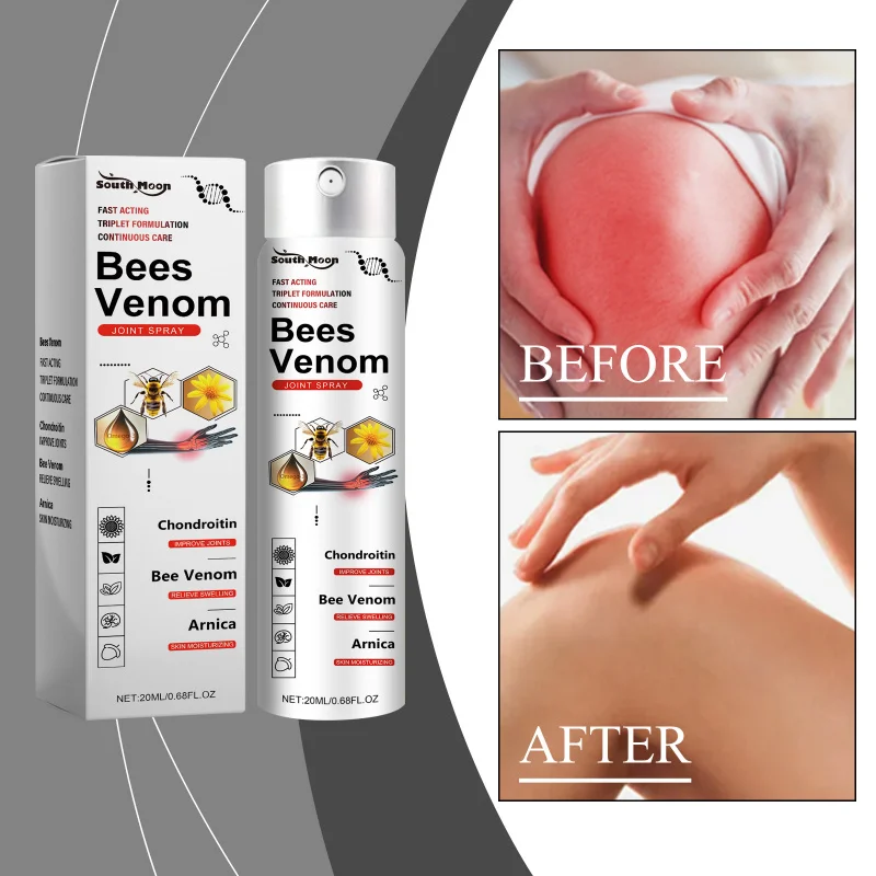 

Joint Care Spray - Alleviate Knee Joint Discomfort, Nourish And Protect Body With Soothing Repair Spray For Daily Wellness