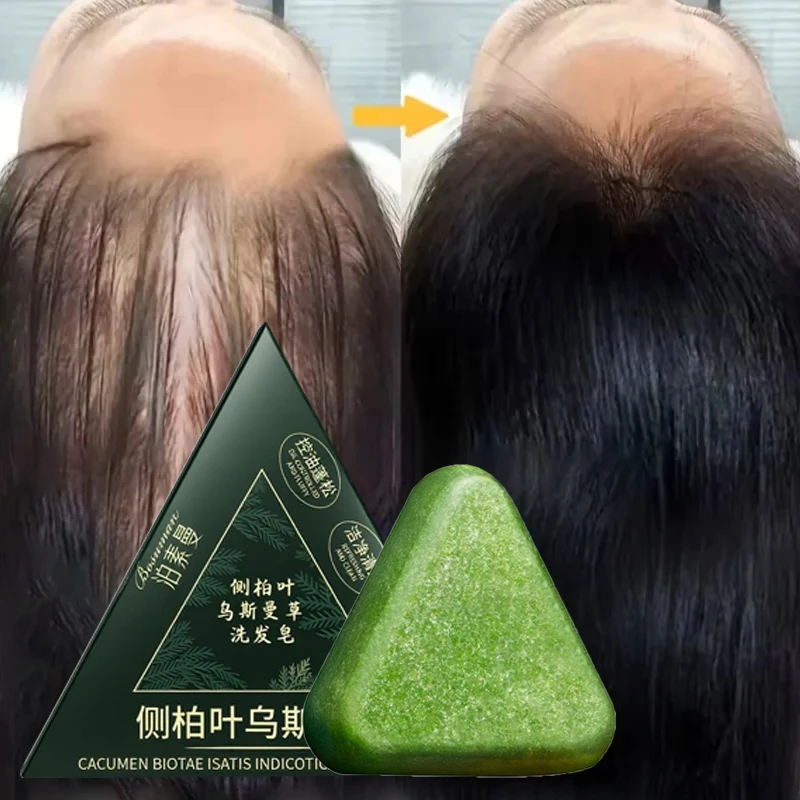 

Для лечения густых волос, травяной шампунь-батон с Orchidaceae Polygonum Multiflorum Usman Grass, естественное очищение с контролем жирности