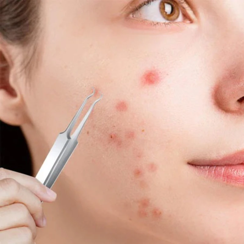 Acne Naald Verwijderen Mee-eter Smet Puistje Zwarte Stippen Mee-eter Extractor Acne Naald Gezichtsreiniger Huidverzorging Gereedschap