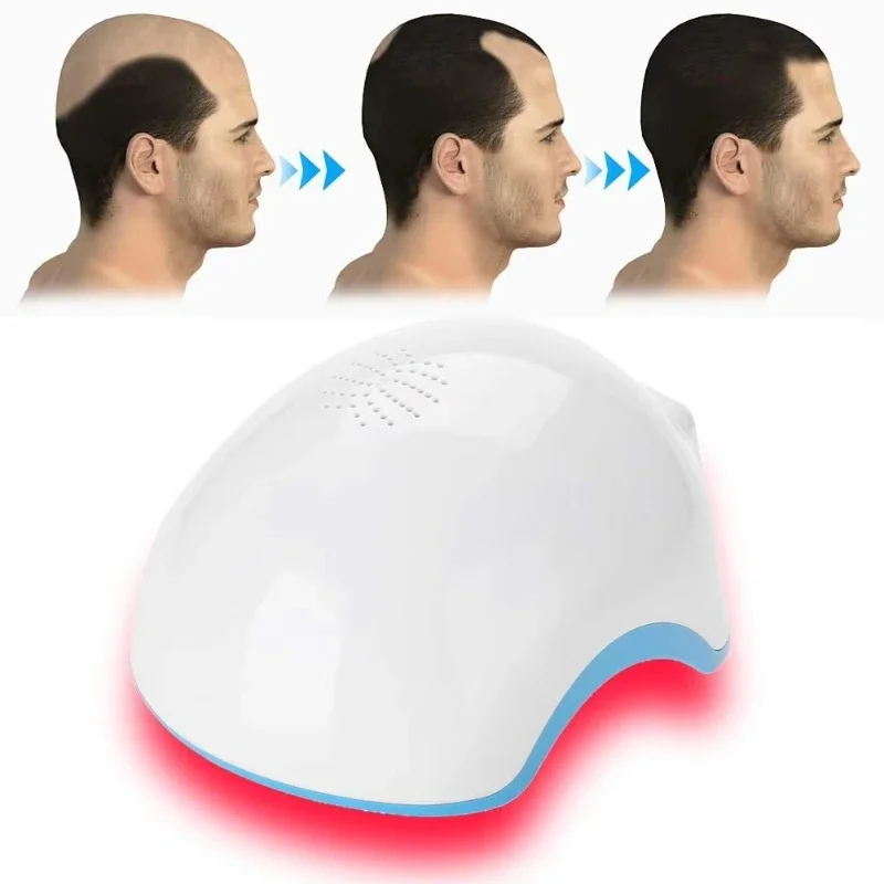 Infrared Red Light Therapy Helmet 80 272 Diode Laser Physical Treatment Laser Hair Growth Cap Anti-Hair Loss Equipment