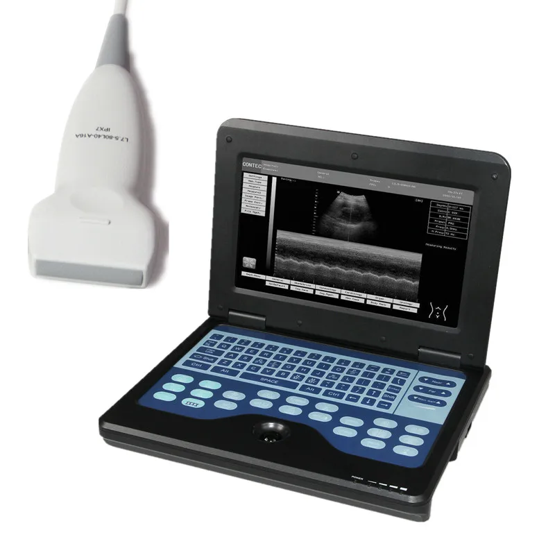 CONTEC CMS600P2 ultrasound scanner laptop machine ultrasonic diagnostic systems with Linear probe