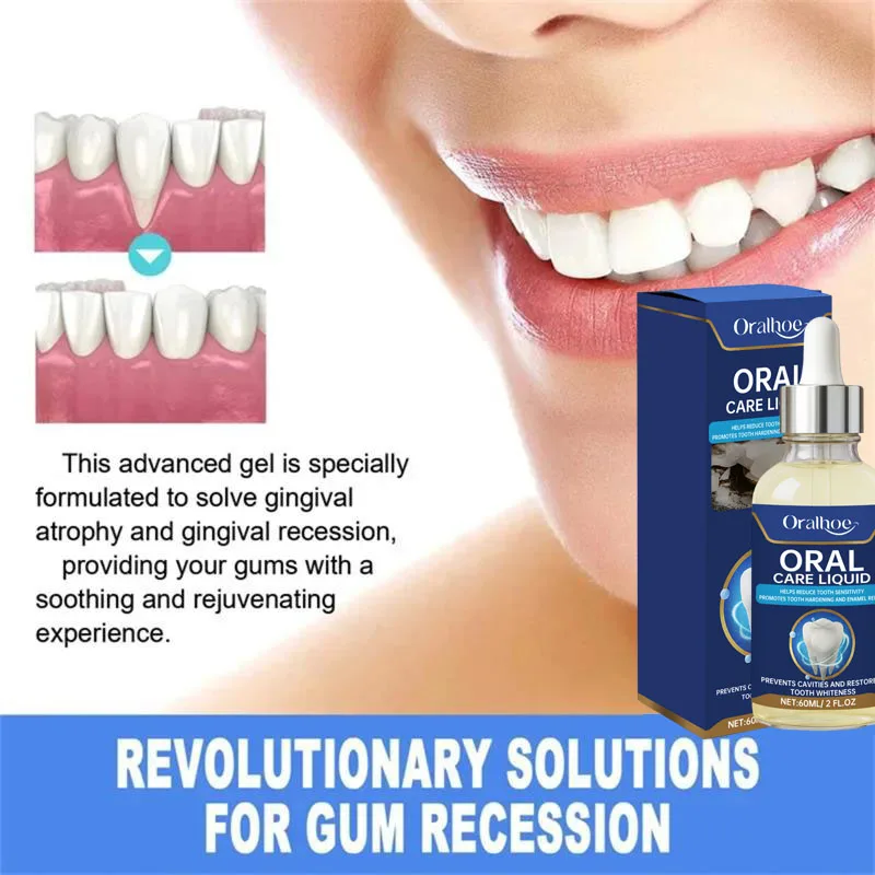 60ML Damaged Gum RepairCare Gel Serum Relieve Sore Gums Allergy Deep Cleaning Teeth Stains Tartar Serum Dental Caries Toothpaste