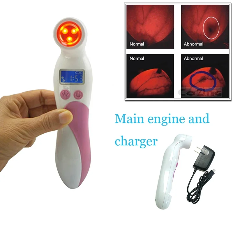 Newest Medical Light Device Breast Red Light Screening Breast Cancer Checking the Breast Whether Have Breast Hyperplasia Lumps