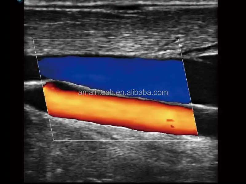 Sonoscape E2 Fabrieksprijs Laptopscanner Ultrasone diagnostische apparatuur Machine Draagbaar