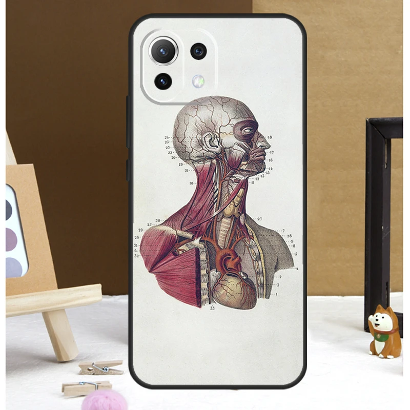 Medical Human Anatomy Case For POCO X6 Pro M6 X3 X4 X5 F3 F5 M5s Xiaomi 13 14 Ultra 12 Lite 11T 12T 13T Pro Cover