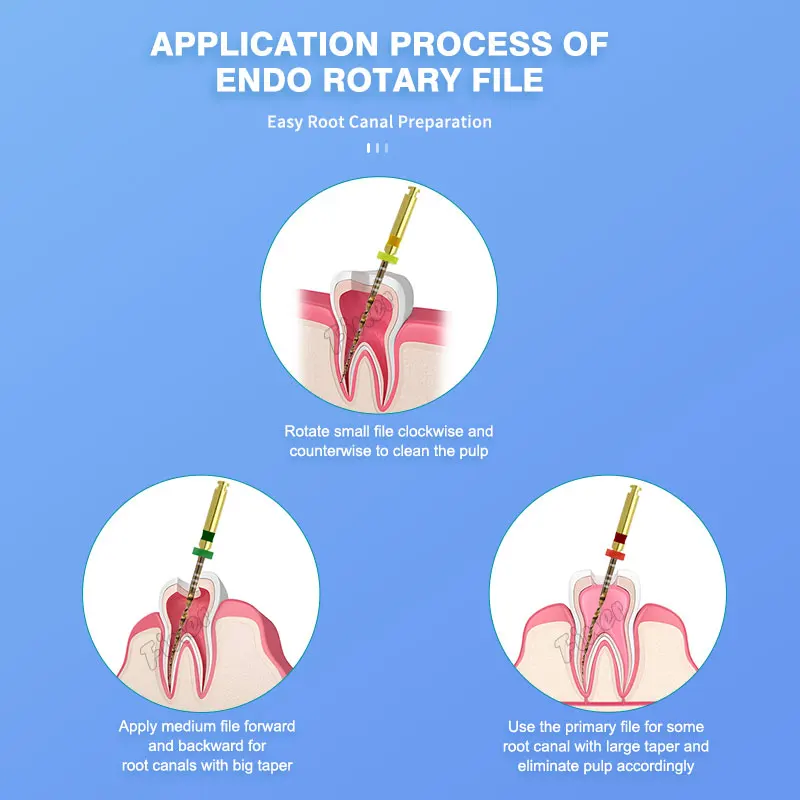 Dental Reciprocating Rotary Endo Files Wave Gold Endo One Files Endodontic Niti File for Endodontic Root Canal Preparation