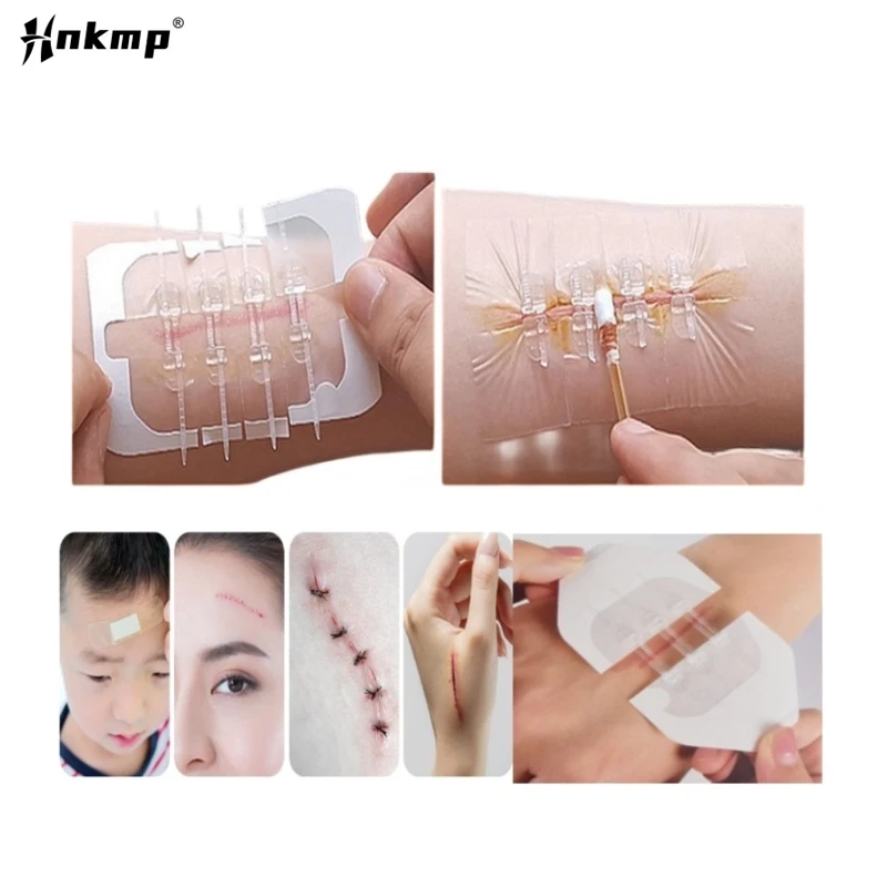 

1/2/3/10Pcs Zipper Tie Wound Closure Patch Hemostatic Patch Wound Fast Suture Zipper Band-Aid Outdoor Portable Skin Care