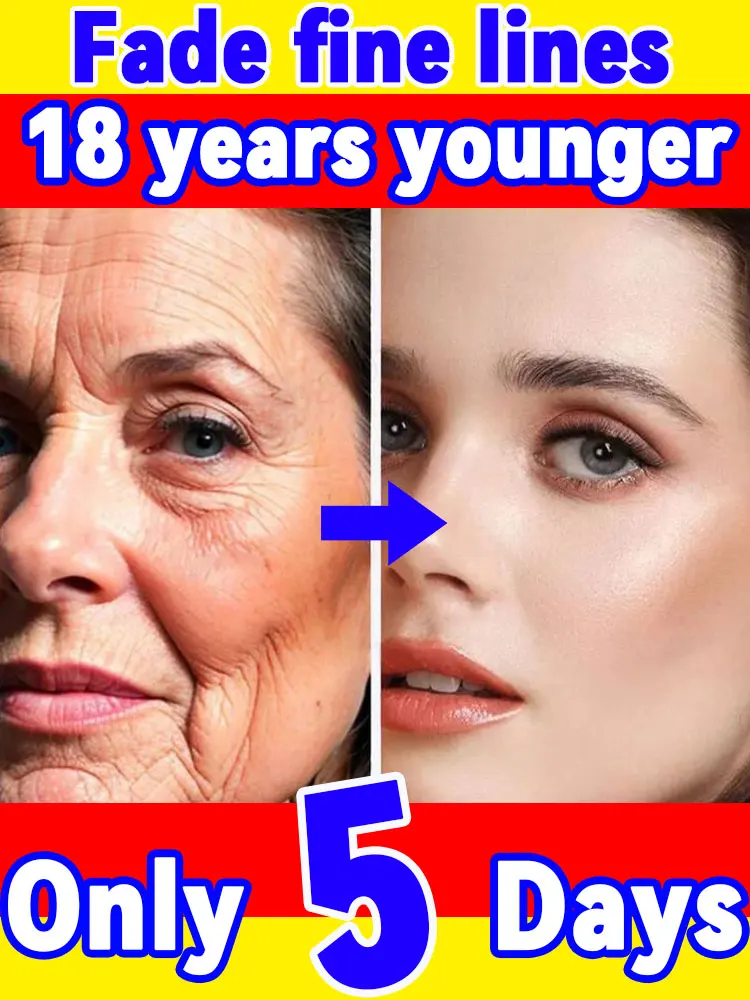

wrinkle，18 years younger
