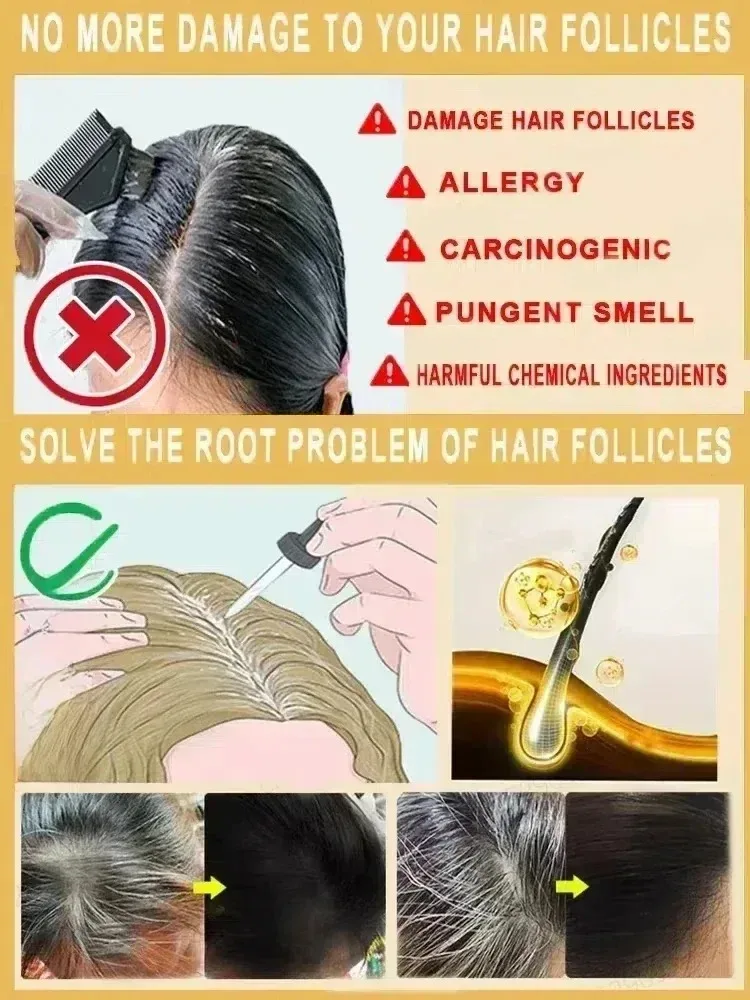 

3nd White To Black Serum Remedy Repair White & Darkening Hair Natural Anti Gray Hair Serum Nourishing Hair Care