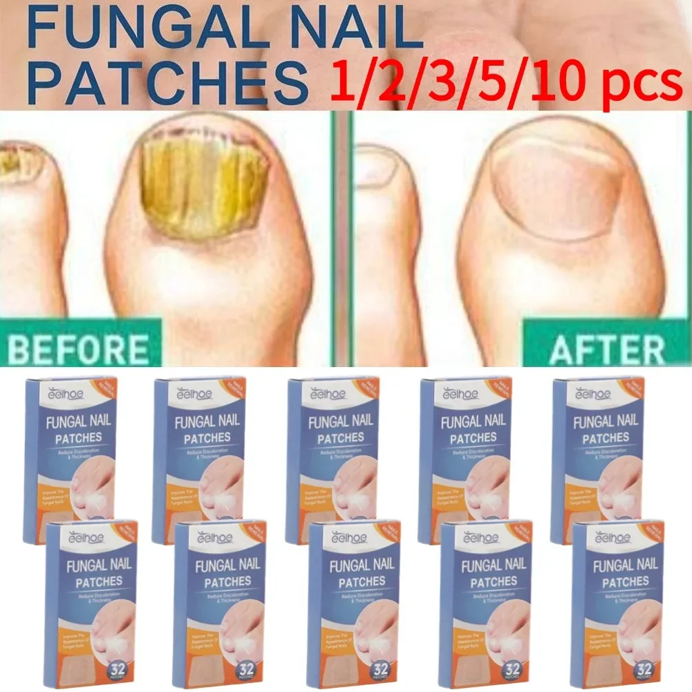 

10/5/3/1Boxes Paronychia Treatment Patch Nails Fungus Removal Stickers Nail Ingrown Correction Sticker Pedicure Tool Health Care