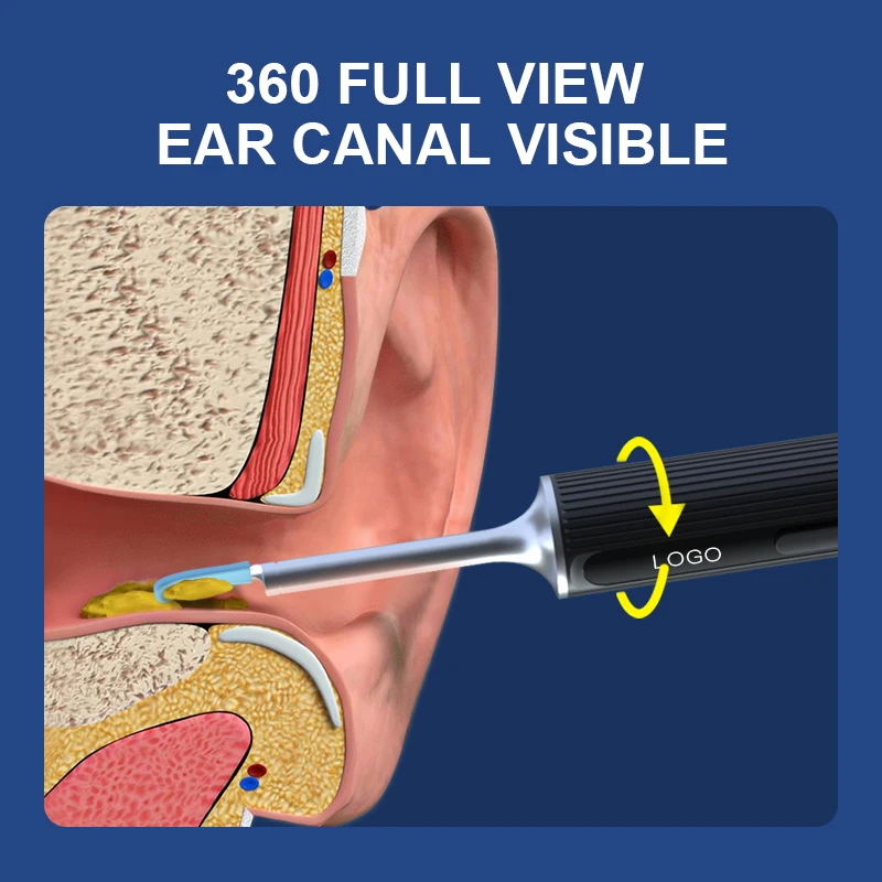 Barra de limpieza inteligente con WiFi, herramienta de eliminación de cera, endoscopio con cámara, 5MP, novedad de 2022