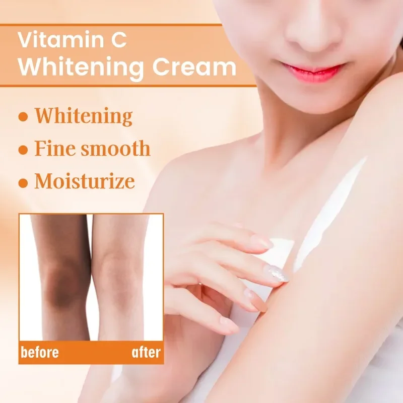 Vitamin C underarm whitening cream remove melanin elbow joints knee Thigh Inner brighten skin  Armpit improve dullness body care