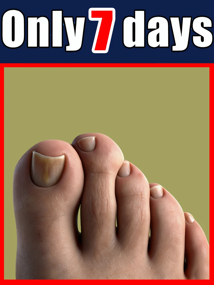 

Generation-2, устройство для терапии синим светом для всей семьи