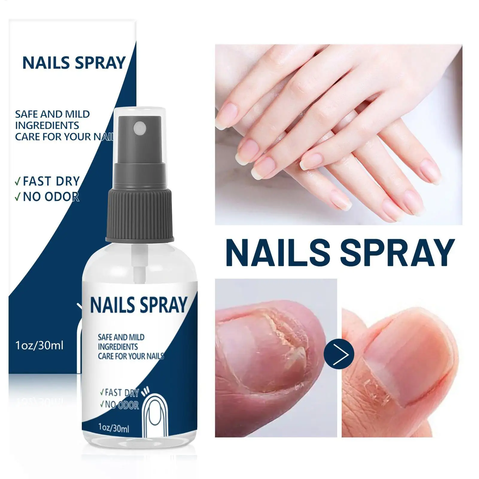 Nail Strengthener Spray - Long-Lasting Renewal Solution for Fingernails & Toenails Care - Nail Nutrition for Women, Girls