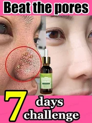 Say no to clogging of pores