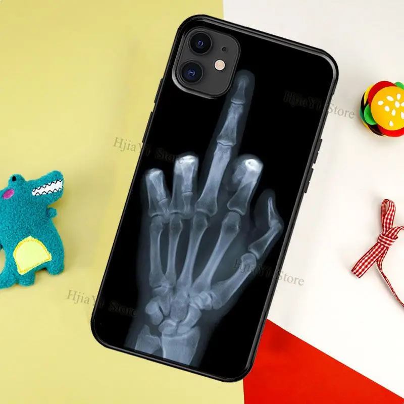 X-ray Hand Bones Case For iPhone 8 6S 7 Plus SE 2020 Cover For iPhone XR X XS 11 12 14 Pro Max 13 mini Coque