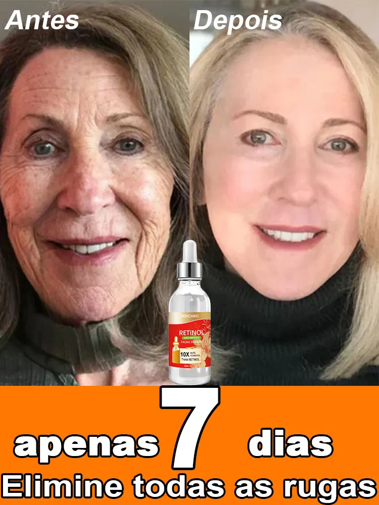 Anti Wrinkle Aging Instant Effect Remove Facial Wrinkles