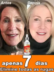 Anti Wrinkle Aging Instant Effect Remove Facial Wrinkles