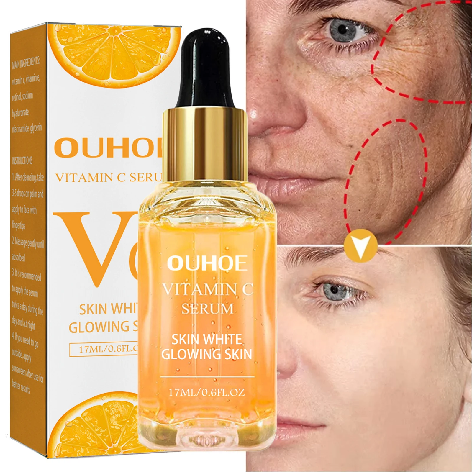 Vitamina c remover manchas escuras soro clareamento anti-rugas ageless firme cuidados com a pele desvanece-se melanina iluminando tom da pele cosméticos