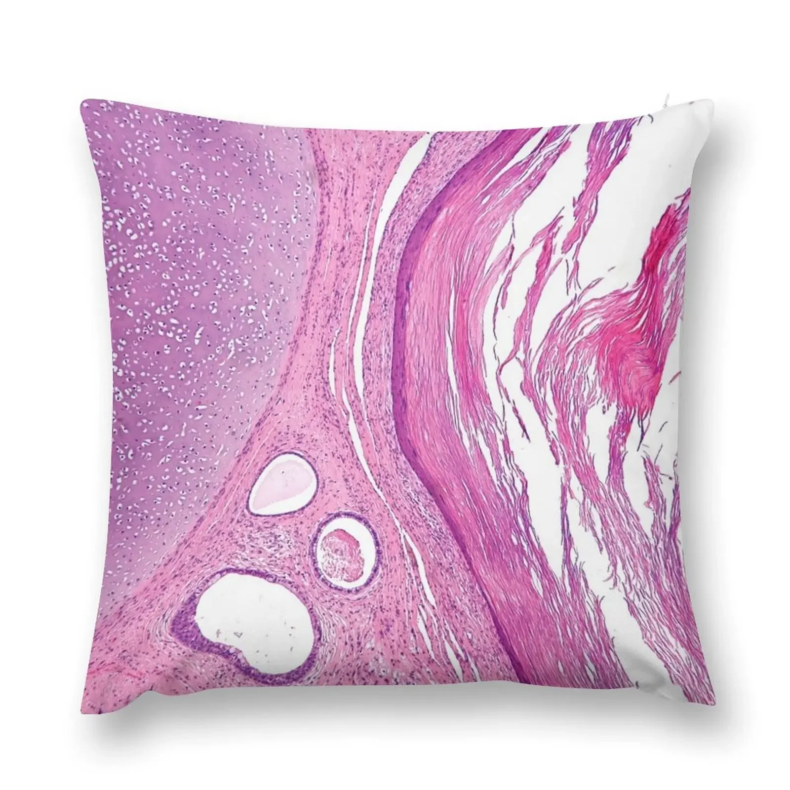 Teratoma Histology Throw Pillow Christmas Pillows Room decorating items Sitting Cushion pillow