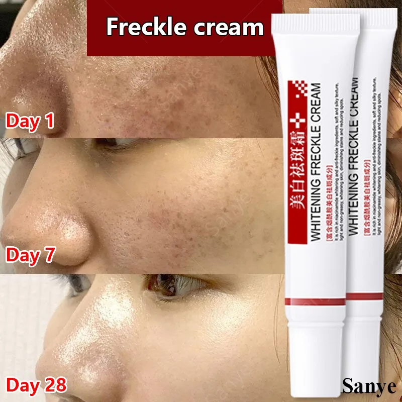 

Women Effective Freckles Cream for Face Fade Melanin Remove Dark Spots Cream Improve Chloasma Whitening Lotion Korean Skin Care