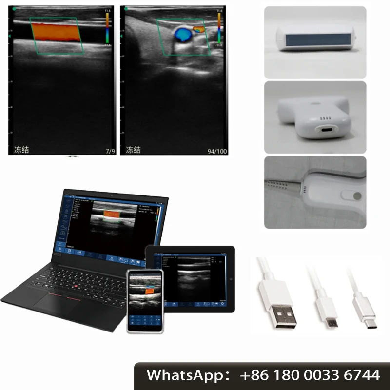 Portable Wireless Ultrasound Probe scanner machine WIFI ultrasound scanner Machine support iOS Android Windows free suitcase