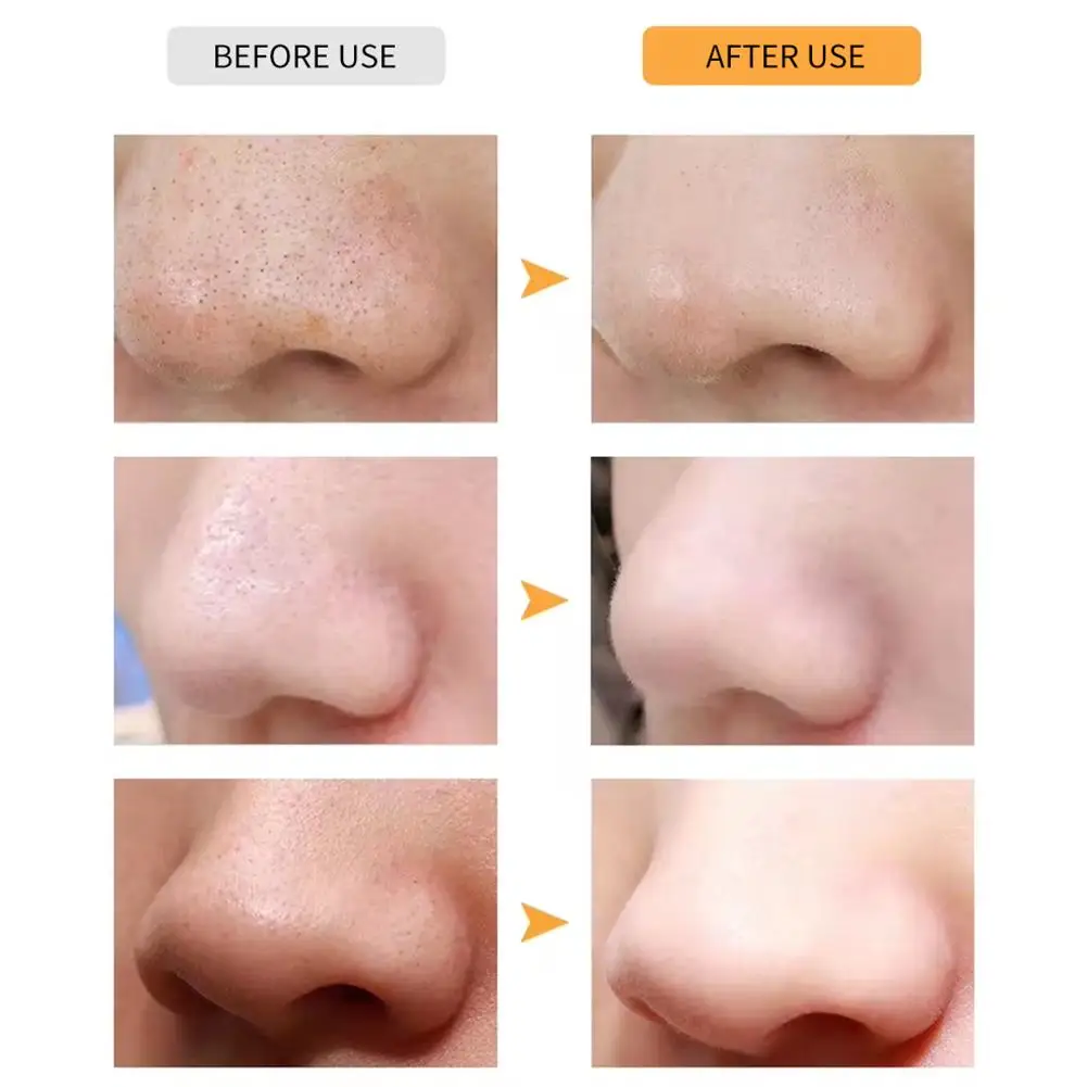 10 szt. Bambusowe Węglowe Paski do Usuwania Wągrów z Nosa, Maseczka na Nos, Naklejki do Usuwania Wągrów, Plastry do Czyszczenia Pór i Trądziku na Białe i Czarne Wągry