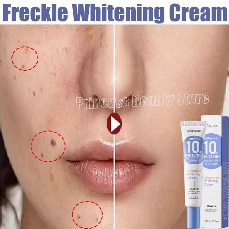 

Dark Spot Removal Serum Remove Melasma Fade Pigmentation Brighter Chloasma Sun Spot Remover Anti Aging Whitening Skin Care Cream