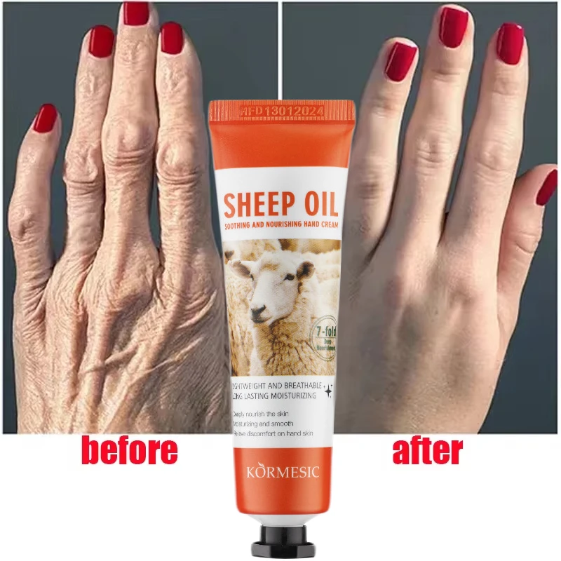 Crème pour les mains déformable à l'huile de mouton, adoucit, nourrit, blanchit, hydrate, répare les fissures, anti-séchage, anti-fissure, produits de réparation