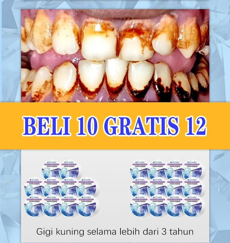 Zap & Glow: Sağlıklı, Işıltılı - Teeth Whitening Zaps incelemesi ve fiyatı