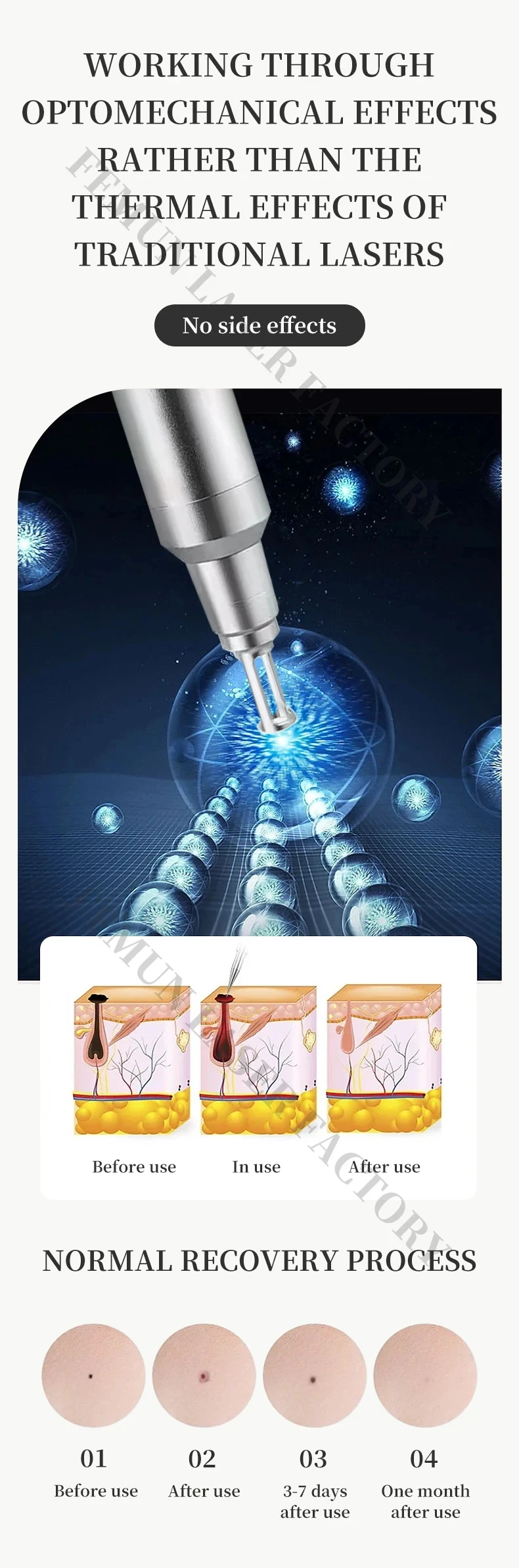 2 In 1 Diode Laser … - image