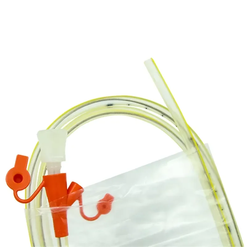 Economic Model Stainless Steel Nasogastric Feeding Tube Soft Tip Transparent Body Flexible Structure Sterile Disposable CE