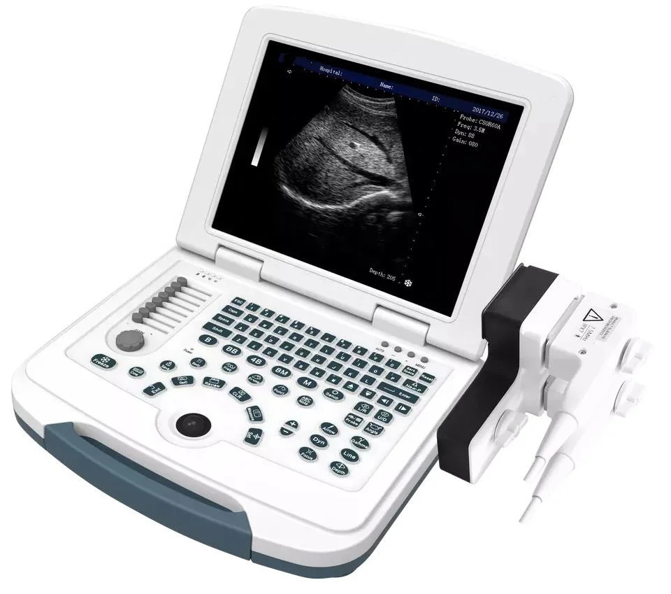 

portable vet ultrasound veterinary Portable Ultrasound Pregnancy Machine For Horses/Goat/Sheep/Dog