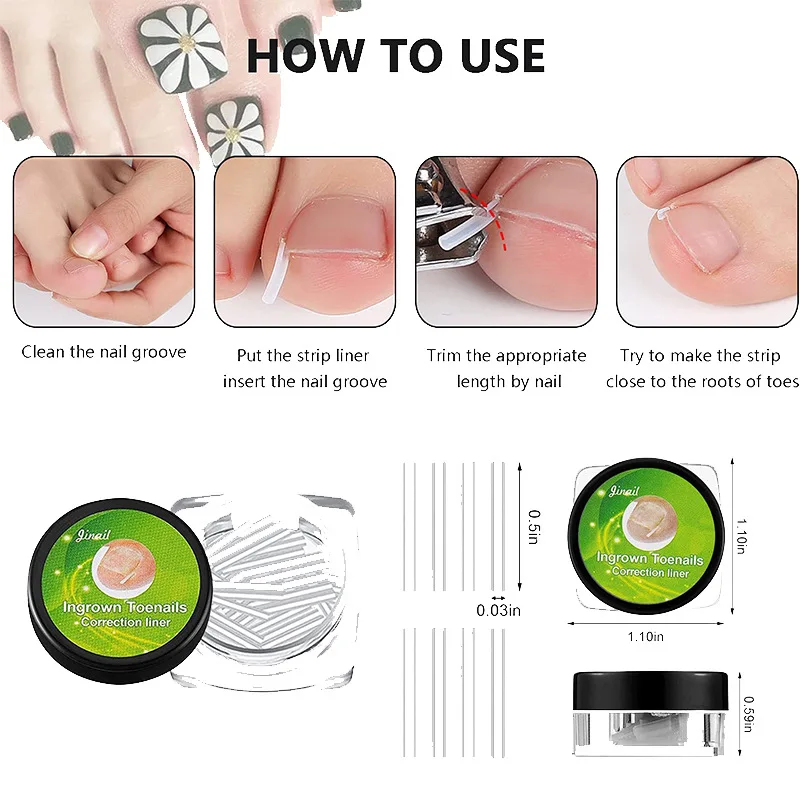 10 pezzi strumento di correzione dell'unghia incarnita trattamento delle unghie dei piedi incarniti adesivo Patch elastico raddrizzamento Clip Brace Pedicure Tool