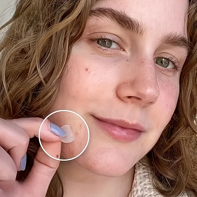 360pcs Hydrocolloid Acne Patches - Absorb Pus & Oil, Reduce Redness, Invisible Fit for All-Day Wear.