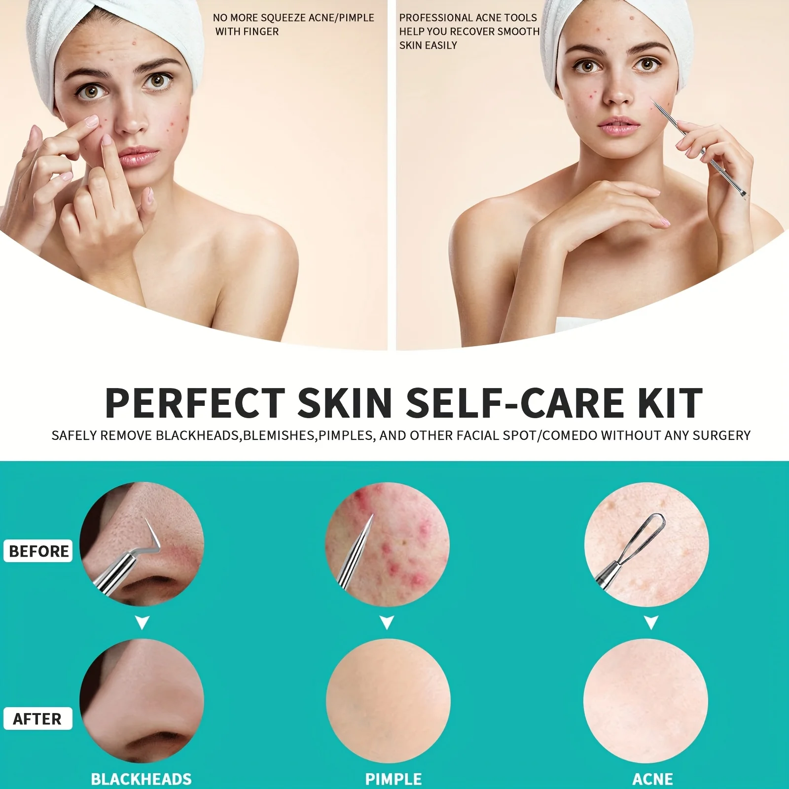 Ferramenta popper de espinhas 3 peças, extrator de espinhas de aço inoxidável, pinça de cravo, kit de remoção de acne extrator de comedões para manchas,