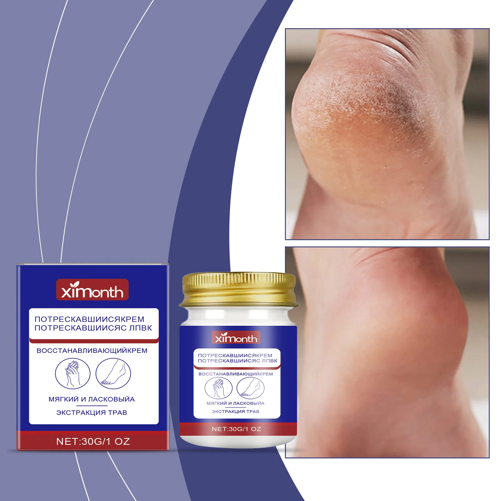 균열 피부 복구 크림 – 허브 추출물이 함유된 강렬한 복원 밤, 매우 부드럽고 영양이 풍부한 손 및 발 트리트먼트, 30g/1온스