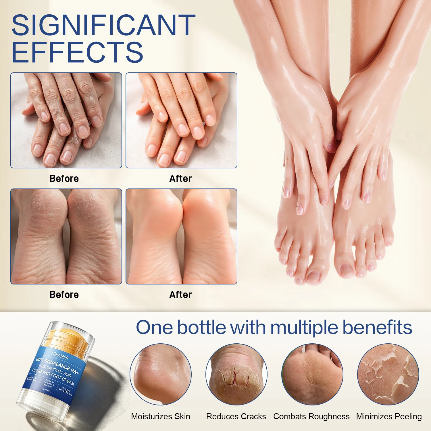 90% Squalan & 2% Salicylsäure Fußcreme Feuchtigkeitsspendende Hand- & Fußcreme für Trockene Haut Stärkung, Verbesserung von Trockenheit & Rauheit – Detail 6
