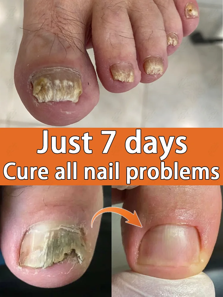 

Nail Polish Herbal Essence, 7 Days to Remove
