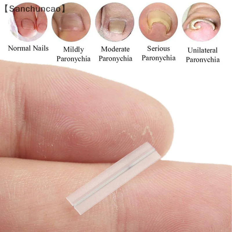 Narzędzie do korekcji wrastających paznokci Klips do prostowania Orteza Wrastający palec u nogi Leczenie paznokci Elastyczna naszywka Narzędzie do pedicure