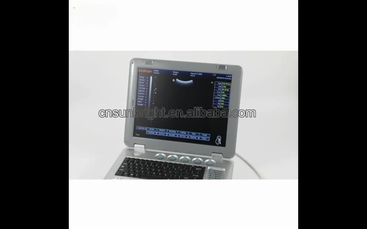 Animal ultrasound diagnose  portable vet digital canine ultrasound machine