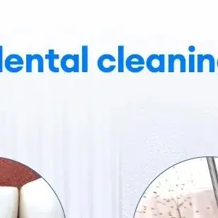 مزيل حساب التفاضل والتكامل الكهربائي مزيل حجر الأسنان لتبييض الأسنان بالموجات فوق الصوتية منظف الأسنان قشارة لوحة الأسنان العناية بالفم #1