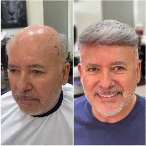 شعر مستعار ريمي للشعر البشري للرجال ، شعر مستعار رجالي ، عقدة مزدوجة ، نظام الشعر الاصطناعي للشعر ، حقن 0.1-0.12 مم أعلى 10 مبيعات بأموال حقيقية في البرازيل - رقم 5