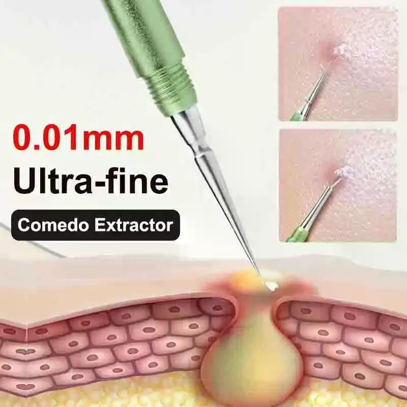 1 Pcs tainless Steel Needles Remove Tools Blackhead Comedone Acne Pimple Blemish Extractor Remover SFace Skin Care Pore Cleaner