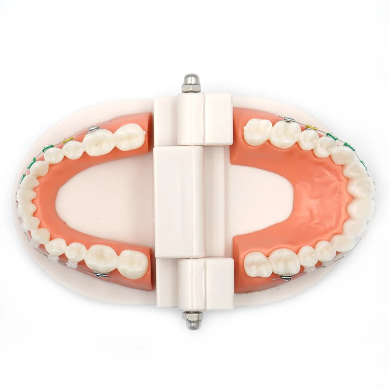 

Модель зубов с кронштейном, арка, проволока, буккальная стоматологическая ортодонтическая трубка, лигатурные стяжки, стоматологические товары, демонстрационные обучающие инструменты