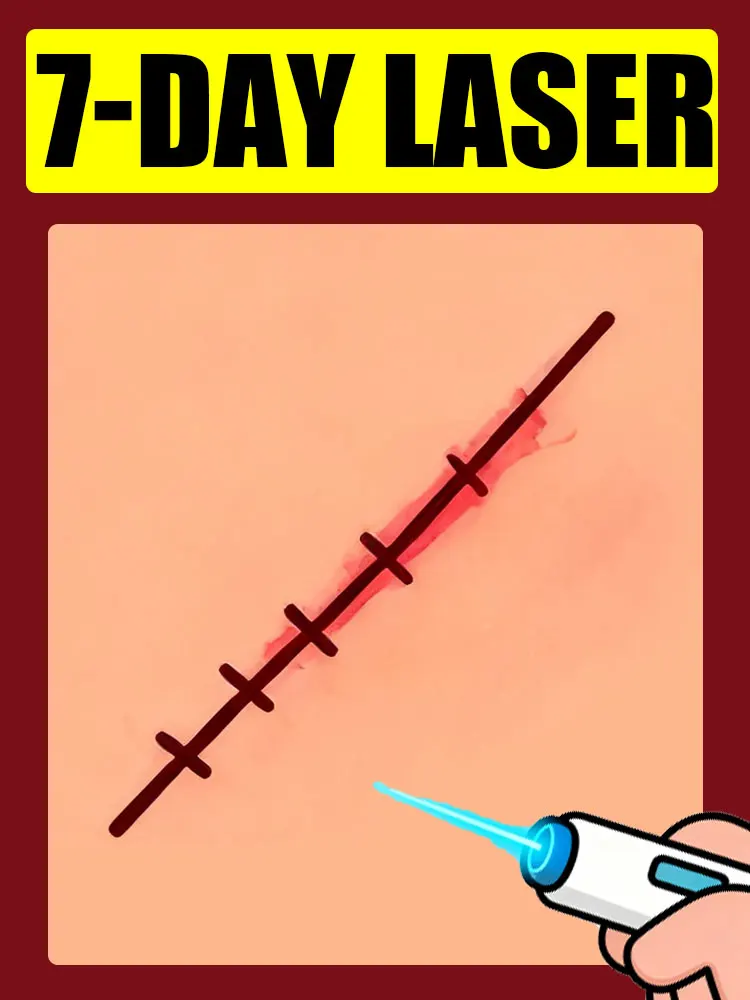 

Second generation laser pens to solve your scar problems and keep your skin healthy