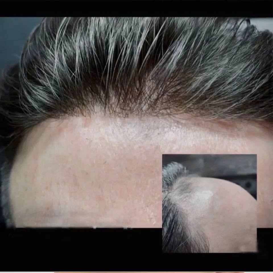 

Men's Wig Durable Full Skin Scalloped Hairline 100% Human Hair Toupee 1B10 1b40 Gray Black Brown Natural Injection Male Prosthes