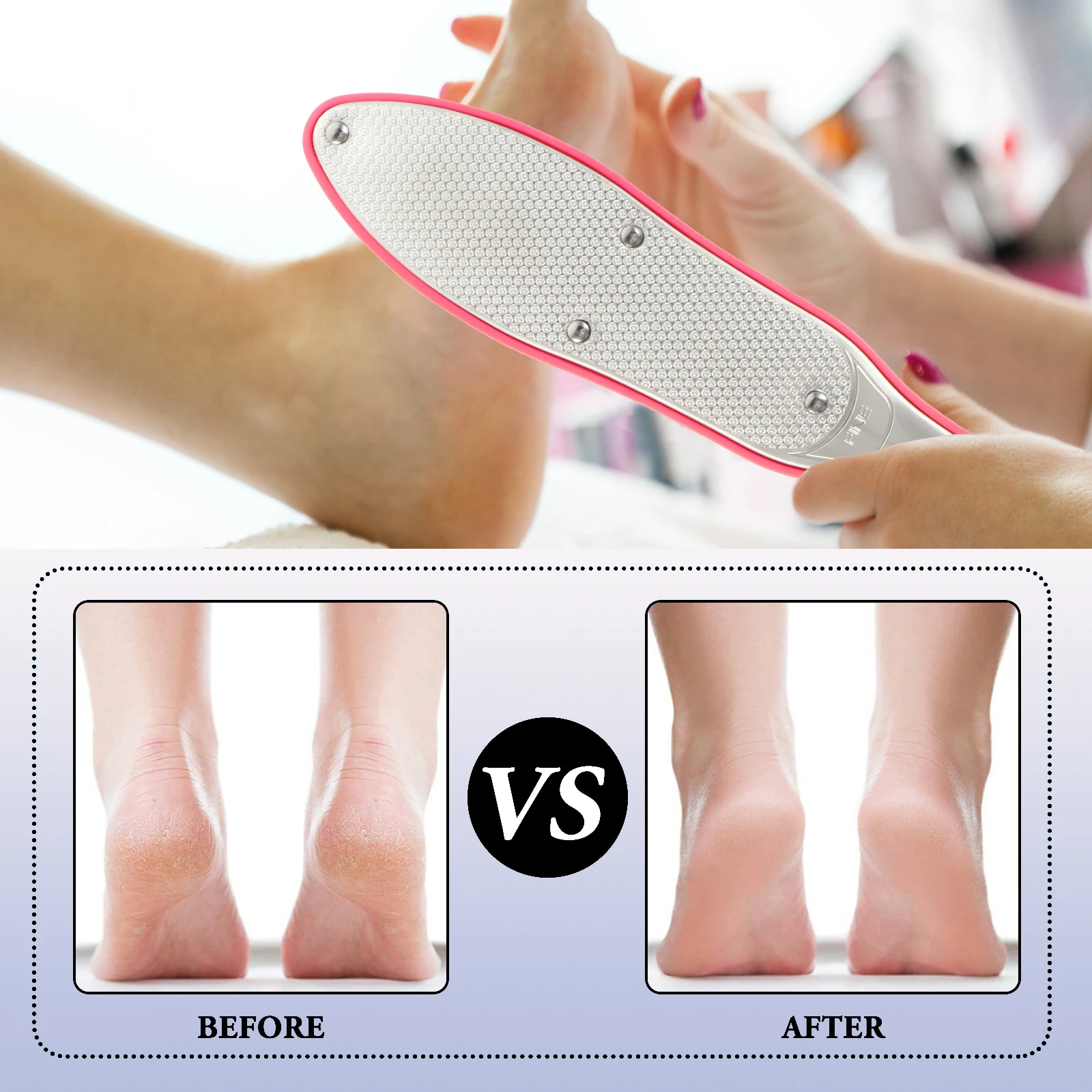 

Stainless Steel Foot File Callus Remover Pedicure Tool Set ABS Extra Blades Feet Scrubber Rasp Nail Care Manicure