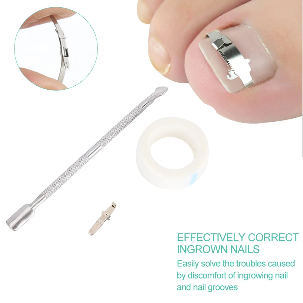 Ingrowing Nail Corrector Ingrown Toenail Correction Paronychia Treatment Foot Care Tool Pedicure Tool Paronychia Treatment Tool