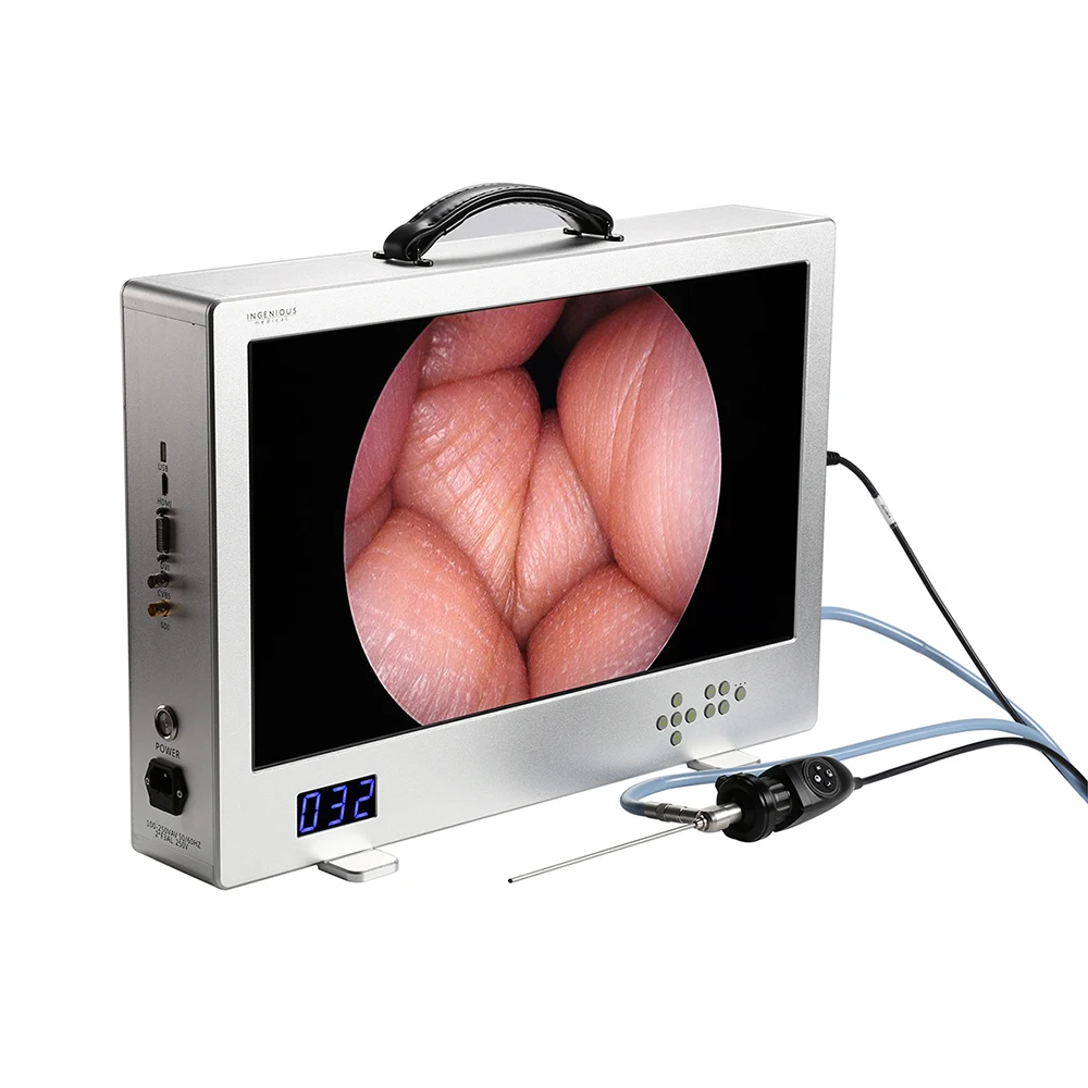 1080P 24 Inches 4 in 1 Integrated Medical Diagnostic Equipment Video Camera System, All in One Portable Hd Endoscope Camera